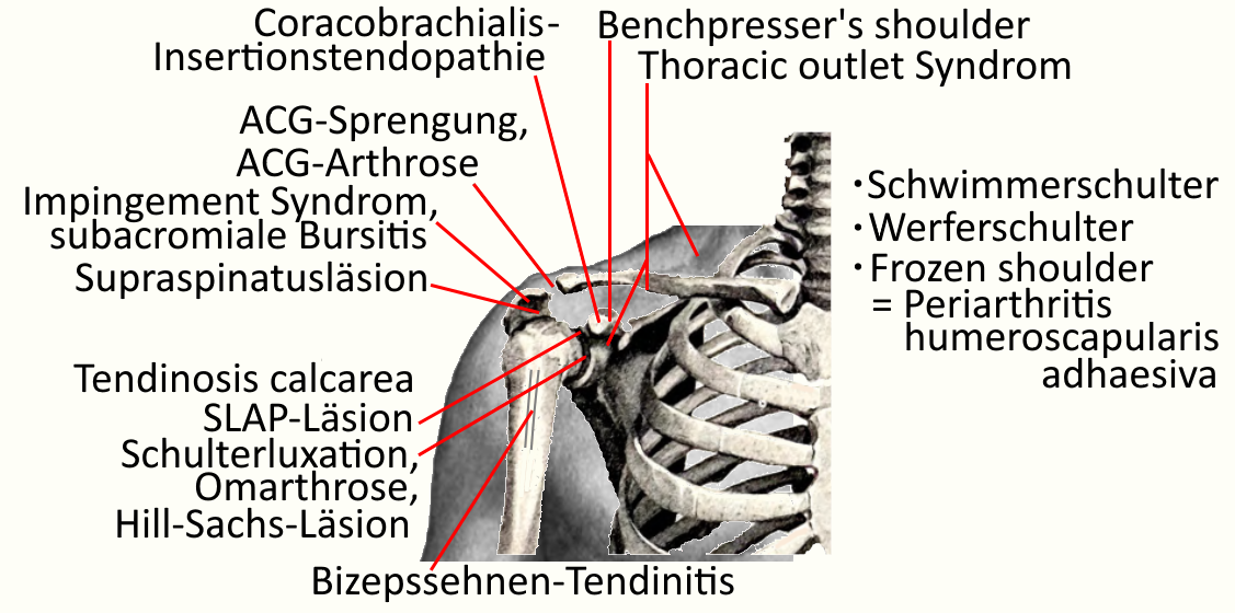 Pathologie Schulter